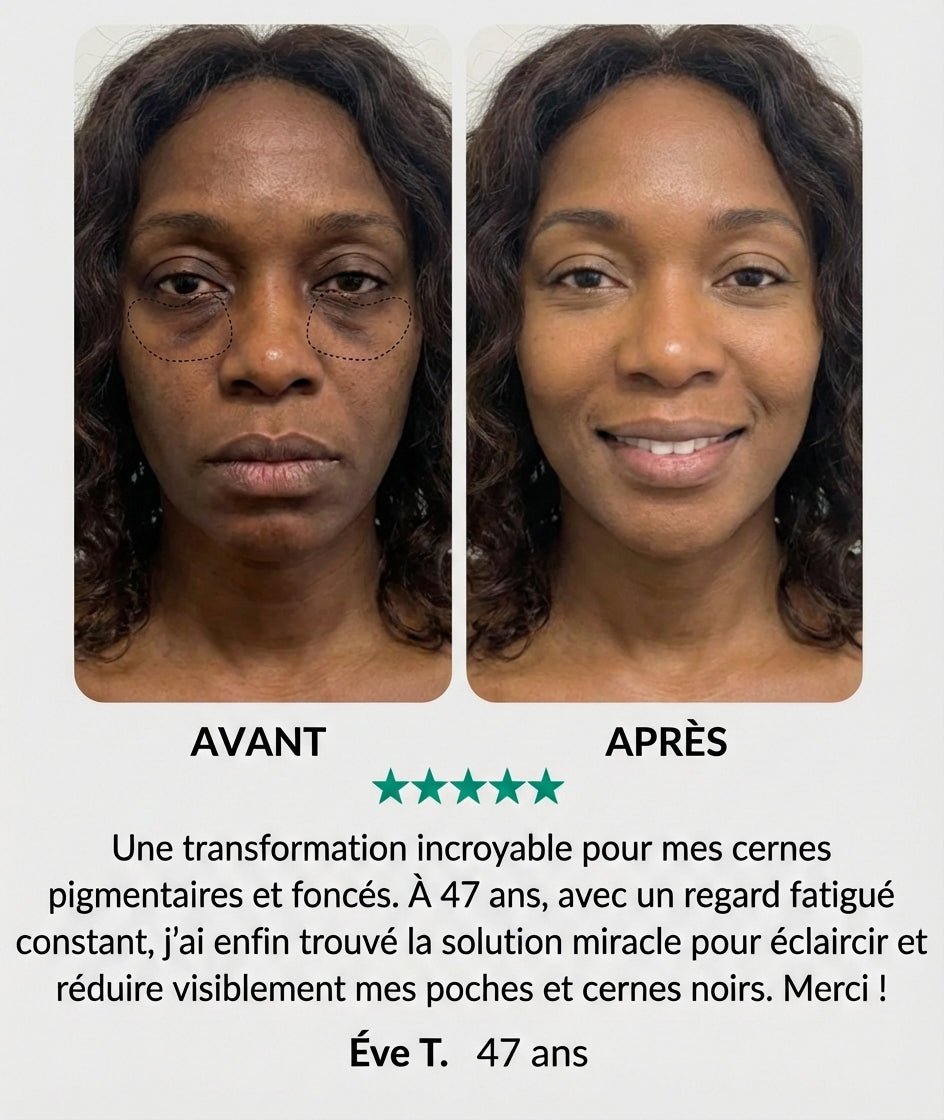 Atténuez visiblement les cernes Foncés et Pigmentaire  - retrouvez un regard lumineux en quelque jours - LUAWE BEAUTY