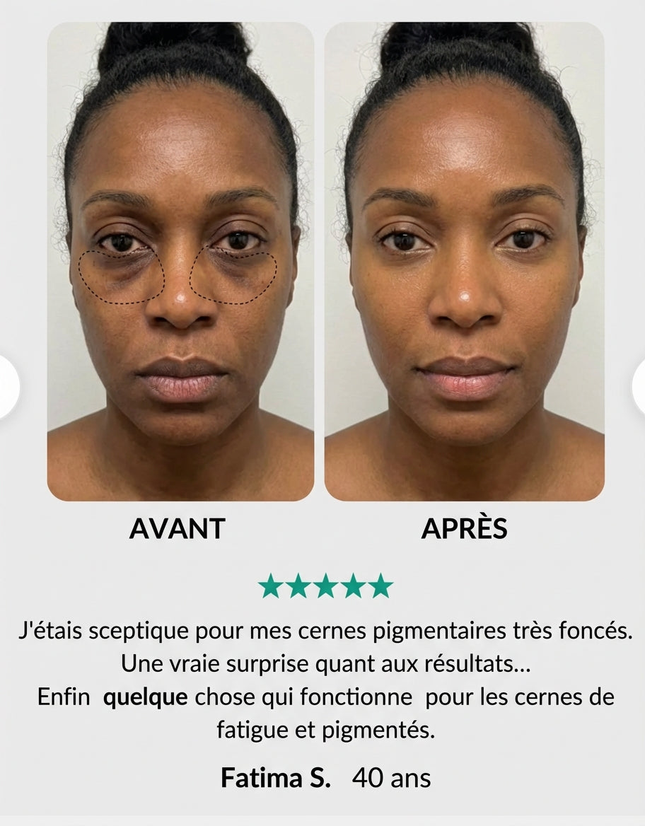 Patch anti-cerne et hyperpigmentation au curcuma - Atténuez visiblement vos cernes foncés et pigmentaires en seulement 15 minutes.