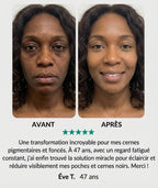 Patch anti-cerne et hyperpigmentation au curcuma - Atténuez visiblement vos cernes foncés et pigmentaires en seulement 15 minutes.
